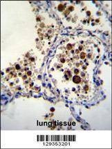 Anti-SIGLEC15 (C-term) Antibody