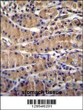 Anti-TEKT5 (Center) Antibody
