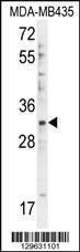 Anti-DTWD1 (Center) Antibody