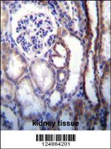 Anti-ATP6V1B1 (Center) Antibody