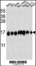 Anti-Interferon-inducible protein (IFITM3) (N-term) Antibody