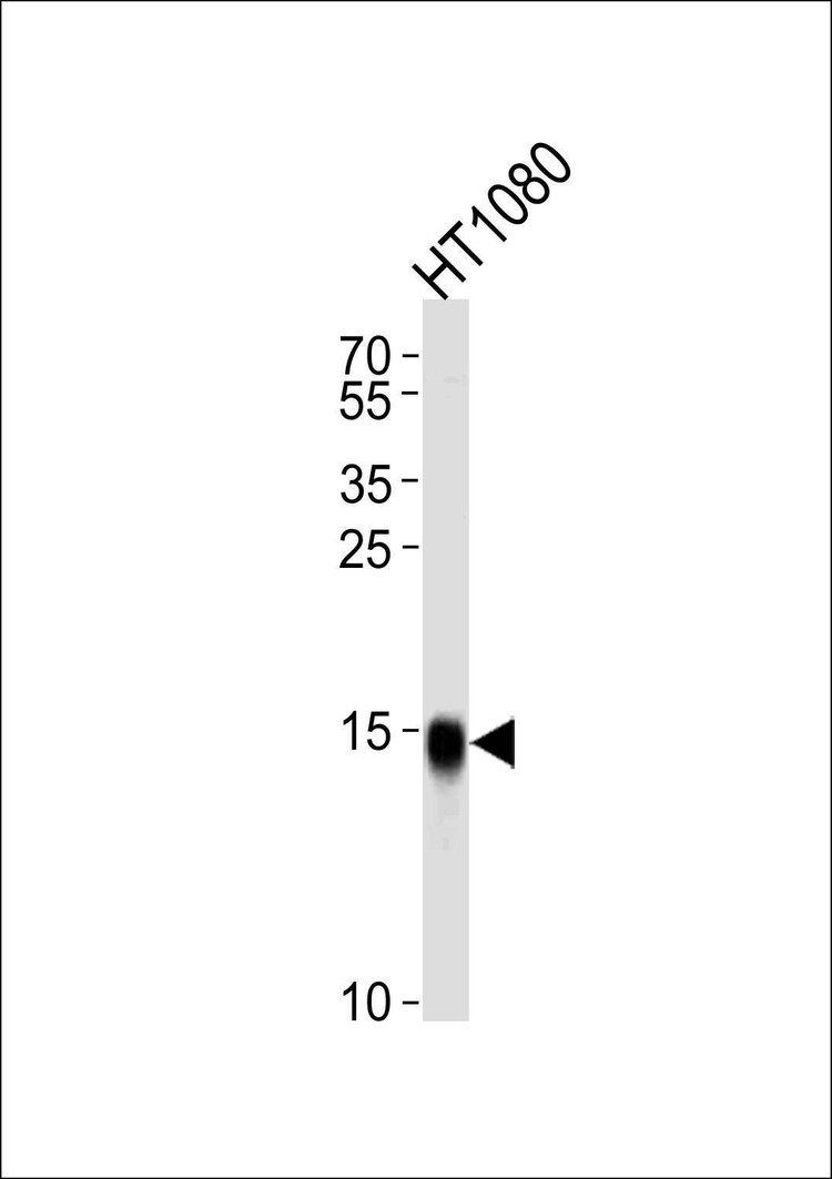 Anti-Interferon-inducible protein (IFITM3) (N-term) Antibody