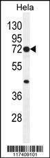 Anti-PTGS2 (Center P378) Antibody