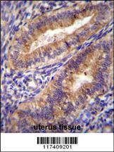 Anti-PTGS2 (Center P378) Antibody