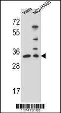 Anti-NTHL1 (Center R103) Antibody
