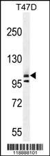 Anti-COL1A2 (N-term) Antibody