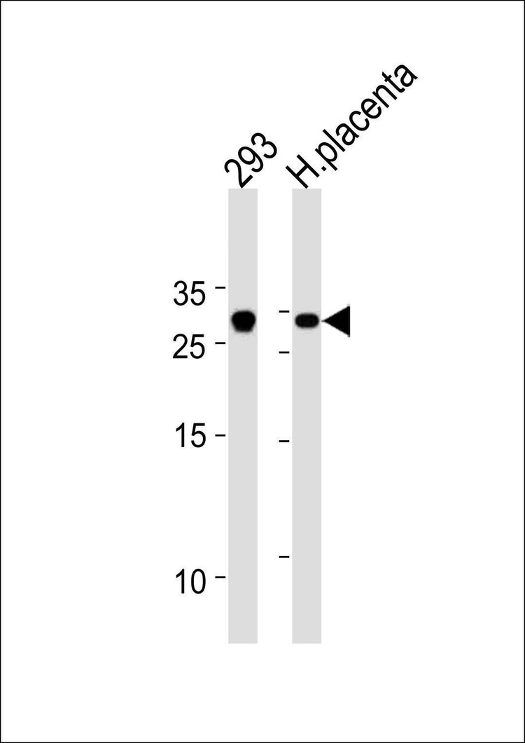 Anti-TCF21 (C-term) Antibody
