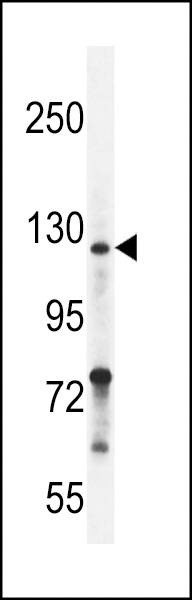 Anti-Neuropilin-2 (C-term K813) Antibody