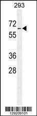 Anti-PLD5 (C-term) Antibody