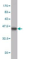 Anti-BFSP1 Antibody