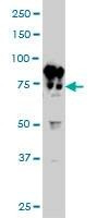 Anti-BFSP1 Antibody