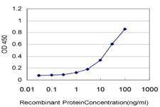 Anti-BFSP1 Antibody