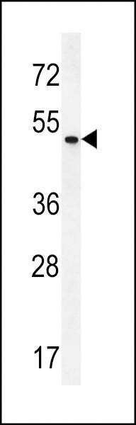 Anti-ZMYND17 (C-term) Antibody