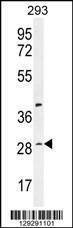 Anti-C19orf38 (Center) Antibody