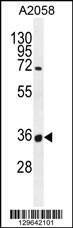 Anti-OR7G1 (N-term) Antibody