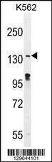 Anti-OVOS (N-term) Antibody
