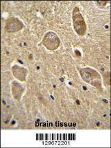 Anti-UGT8 (Center) Antibody