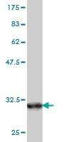 Anti-BGLAP Antibody