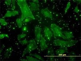 Anti-BGLAP Antibody