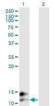 Anti-BGLAP Antibody