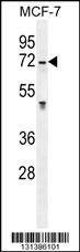Anti-GALNS (Center) Antibody