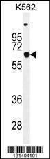 Anti-SLC16A8 (C-term) Antibody