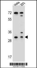 Anti-EFNB2 (Center) Antibody