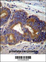 Anti-YI016 (C-term) Antibody