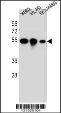 Anti-YI016 (C-term) Antibody