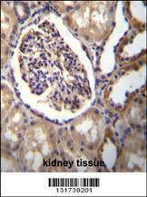 Anti-AKR1C3 (Center) Antibody