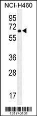 Anti-CHRND (Center) Antibody