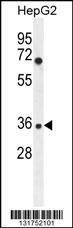 Anti-IGHG1 (Center) Antibody