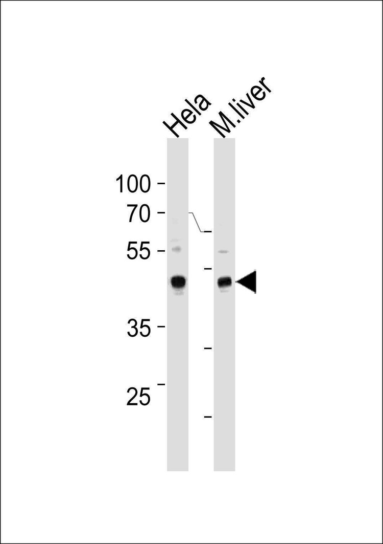 Anti-TBX6 (Center W158) Antibody