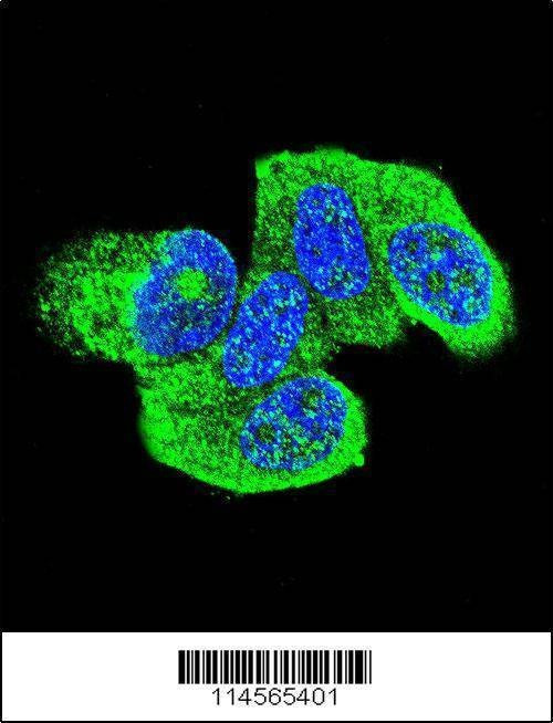 Anti-HRAS (C-term) Antibody