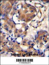 Anti-KNG1 (N-term) Antibody