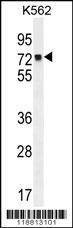 Anti-MLH1 (Center) Antibody