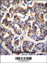 Anti-p16INK4a (C-term E119) Antibody