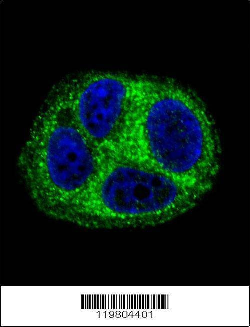 Anti-QTRTD1 (C-term) Antibody