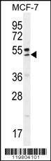 Anti-QTRTD1 (C-term) Antibody