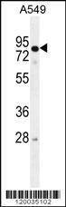 Anti-RAD17 (Center) Antibody