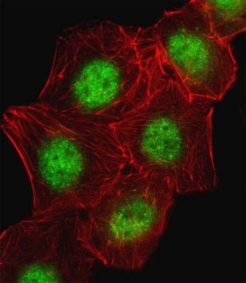 Anti-CREB1 (Center) Antibody