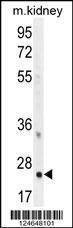 Anti-Mouse HOXB6 (Center) Antibody