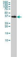 Anti-BLVRA Antibody