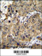 Anti-TMEM100 (C-term) Antibody