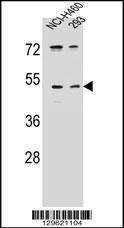Anti-UNQ9391 (C-term) Antibody