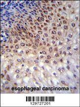 Anti-CCDC36 (C-term) Antibody
