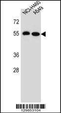Anti-LRRC6 (Center) Antibody