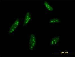 Anti-BMP2K Antibody