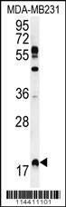 Anti-RHEB (C-term) Antibody