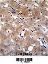 Anti-TRPM8 (Center) Antibody